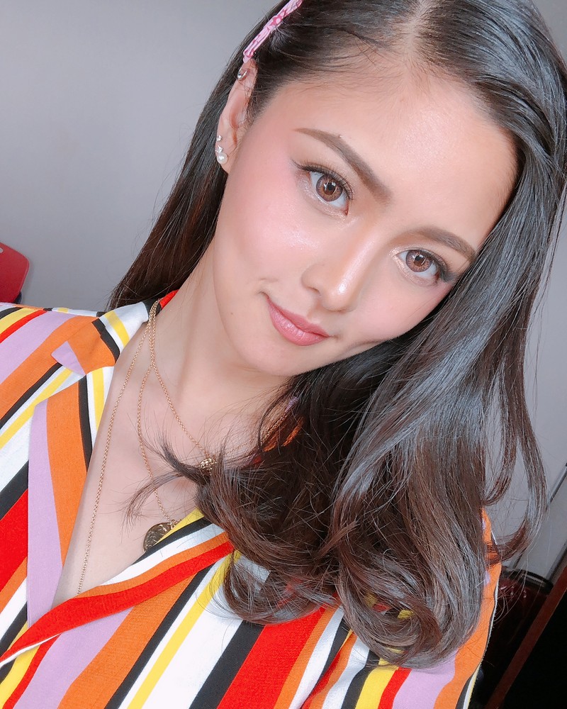 Kim Chiu Biography